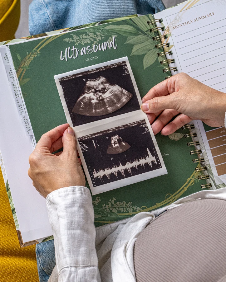 MallowMarsh™ pregnancy journal resting on a soft blanket